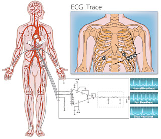 ecg_trace